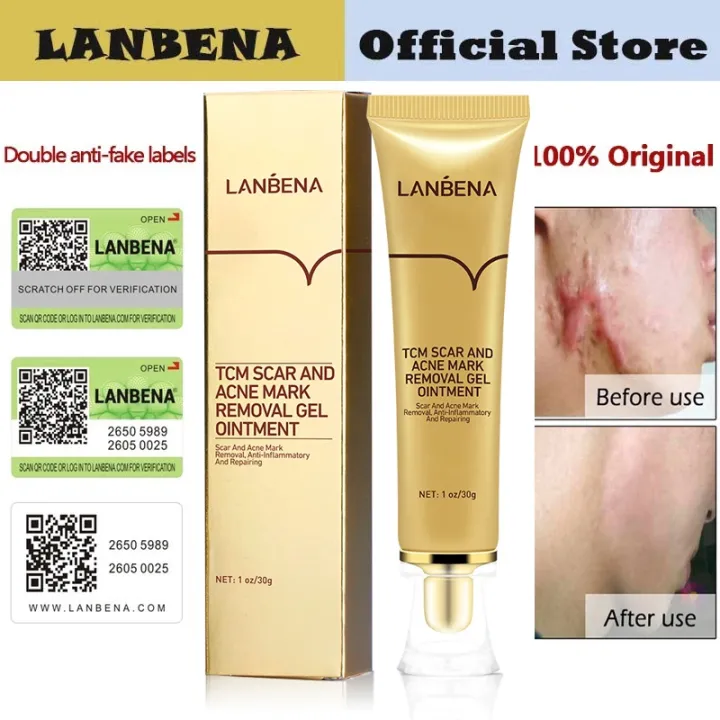 TCM%20Scar%20&%20Pimple%20Mark%20Remover%20Gel%20Ointment%2030g%20-%20Image%205