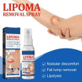 Lipoma Removal Spray Anti Tumor Skin Swelling Pain Lipolysis Cellulite Treatment Fibroma Subcutaneous Fat Lump Relief Cream 50ml. 