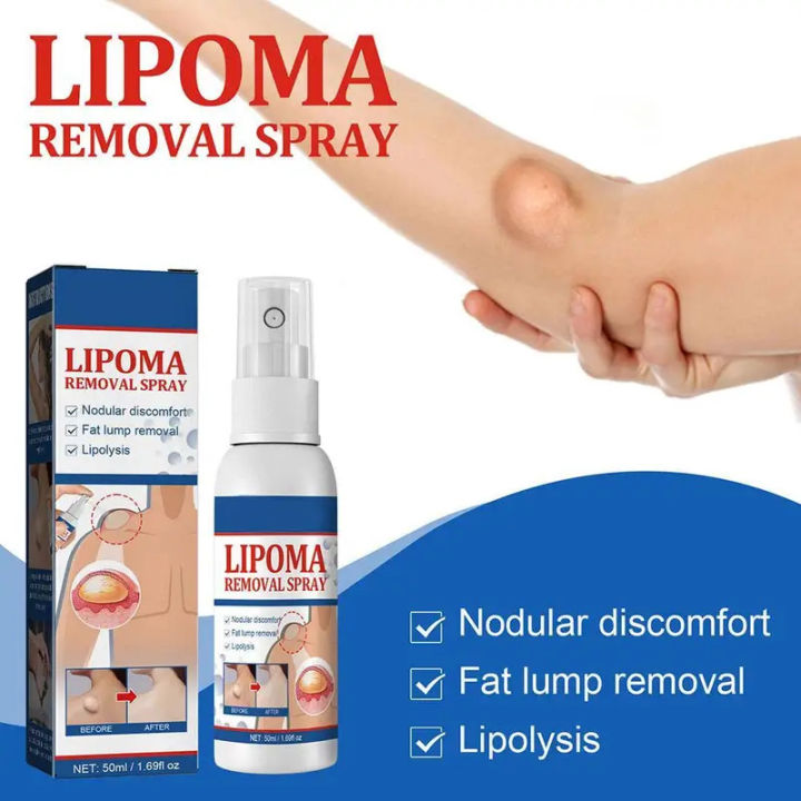 Lipoma%20Removal%20Spray%20Anti%20Tumor%20Skin%20Swelling%20Pain%20Lipolysis%20Cellulite%20Treatment%20Fibroma%20Subcutaneous%20Fat%20Lump%20Relief%20Cream%2050ml%20-%20Image%203