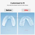 HEGRUS 4PCS Orthodontic Braces Teeth Guard Night Mouth Guard Dental Night Guards Dental Cover Teeth Retainer Tray for Teeth Grinding Clenching Bruxism Snoring Kids Adult. 