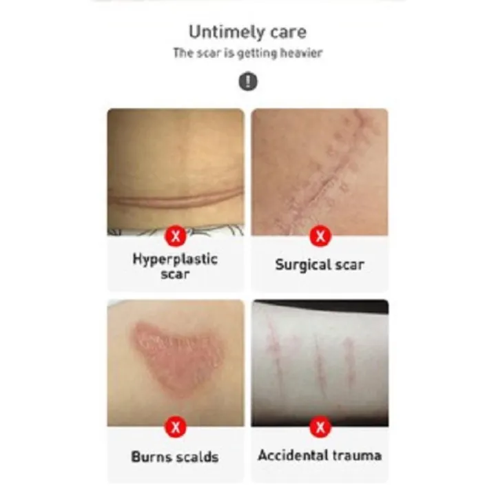 LANBENA%20Skin%20care%20gel%20-%2030g%20-%20Image%203