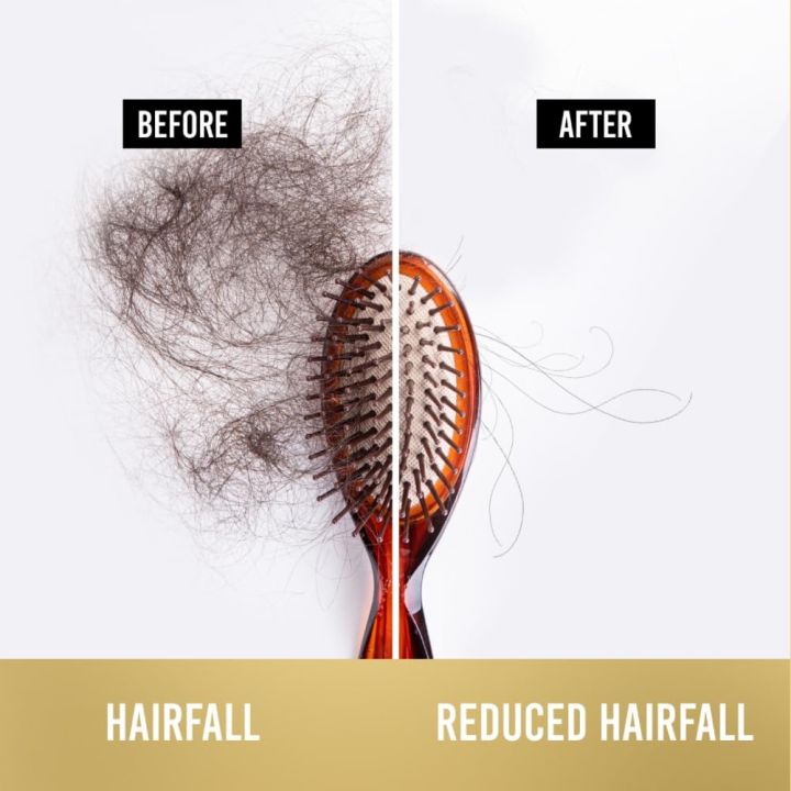 Pantene%20Hair%20Fall%20Control%20Shampoo%20PRO%20-%20V%201L%20-%20Image%202
