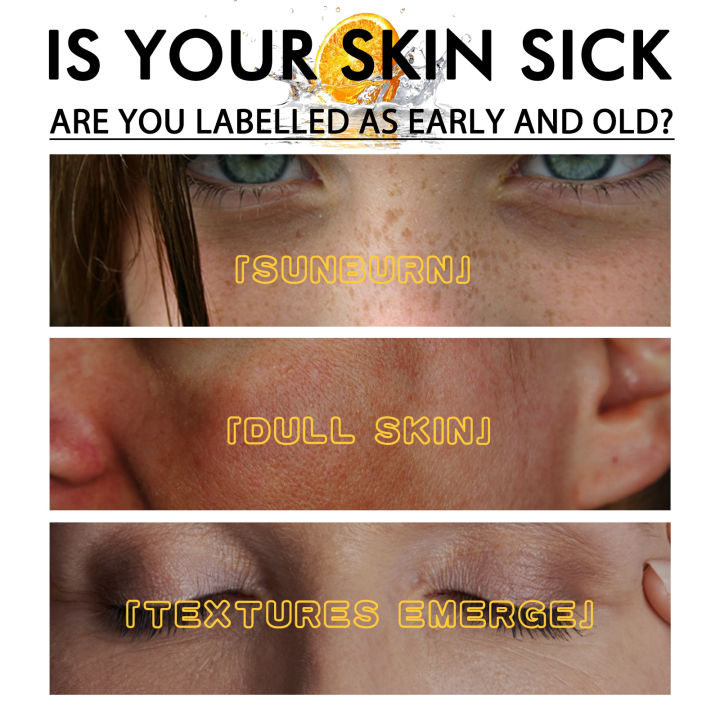 EELHOE%20Vitamin%20C%20Serum%20for%20Face%20Freckle%20Remover%20Fade%20Dark%20Spot%20Pigment%20Melanin%20Corrector%20Brighten%20Skin%20Face%20Moisturizing%20Serum%20-%20Image%206