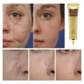 TCM Scar And Acne Mark Removal Gel Ointment Cream. 