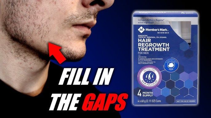 Kirkland%20Minoxidil%205%25%20USA%20One%20Month%20Supply%20+%20Free%20Dropper%20-%20Image%203