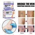Varicose Vein Treatments Cream Effective Relieve Legs Dilated Vasculitis Phlebitis Natural Formula Ointment For Varicose Veins. 