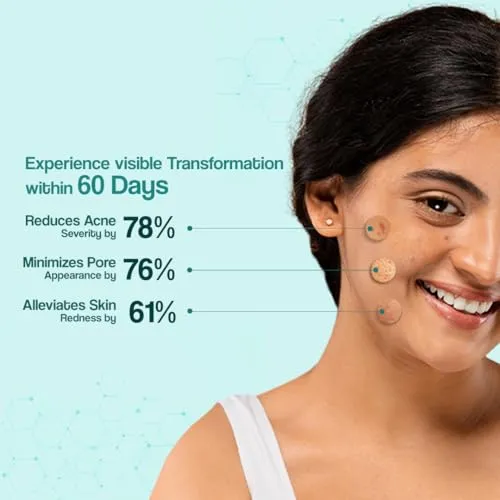 VENUSIA%20Dr.%20Reddy's%20Acne%20Control%20Moisturizer%20I%20For%20Oily%20&%20Acne%20Prone%20Skin%20I%20Prevents%20Acne%20Breakouts%7COil%20Free,%20Non%20Sticky%20I%2075G%20(FROM%20INDIA)%20-%20Image%203