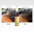 Deyga Hair Growth Oil | Promotes Hair Growth | Reduces Hairfall | Repairs Damaged Hair | Makes Hair Soft & Smooth | Infused with Hibiscus, Rosemary & Grapeseed Oil (100 ML, Hair Growth Oil) | Suits Men and Women (FROM INDIA). 