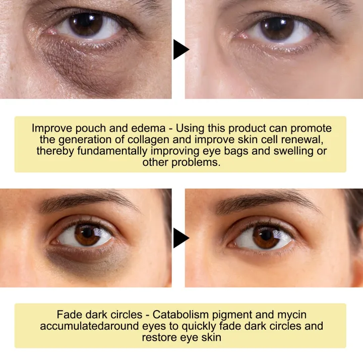 Collagen%20Gold%20Eye%20Mask%20Remove%20Dark%20Circle%20Anti%20Aging%20Puffiness%20Eye%20Bag%20Removal%20Fade%20Wrinkle%20Fine%20Line%20Moisturizing%20Eye%20Patches%20-%20Image%205