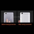 For Asus ROG Phone 7 6 6D 5 5s Ultimate 3 Strix 3D Anti-fingerprint Carbon Fiber Back Skin Film Sticker Screen Protector. 