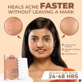 Sanfe Promise Face Acne Clearing Glo Patch - Used As Spot Treatment, 10 g 36 pcs. 