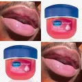 Vaseline Rosy Lips Lip Therapy Pure Petroleum Jelly Balm 0.25oz for Dry Lips. 