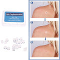 20pcs Skin Tag Removal Rubber Bands Micro Band Non Toxic Face Care Mole Wart Skin Care Tools. 