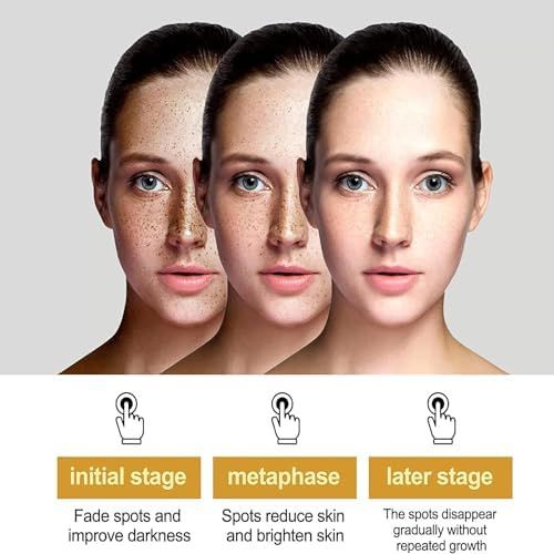 BOTOWI%20Saam%20Face%20Cream,%20Japanese%20Melasma%20Cream,%20Dr%20Hancy%20White%20Spot%20Cream%20China,%20Yunnan%20Herbal%20Whitening%20and%20Freckle-removing%20Cream,%20Saam%20Cosmetics%20Cream%20Dark%20Spots%20Cream,%20Dark%20Spot%20Corrector%20(1PCS)%20%20FROM%20DUBAI%20(SAM)%20-%20Image%203