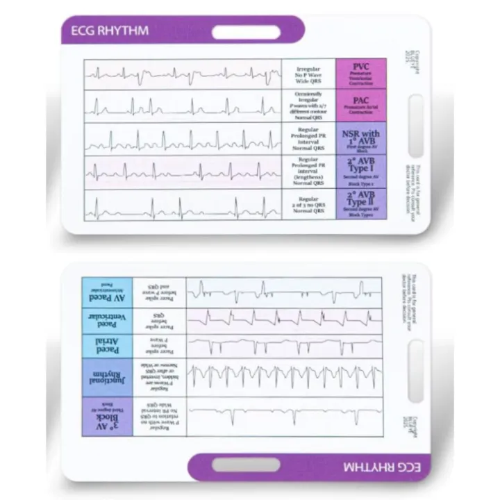 High Quality Quick Reference EKG Rhythm Interpretation Card Dual-Sided ...