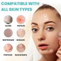 Tea Tree Essential Acne Patches Waterproof Pimple Patch for Control, Redness Repair, Whitehead Improvement Skin Care. 