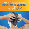 Nizoral Daily Care - Anti-Dandruff Shampoo 200ml (FROM DUBAI). 