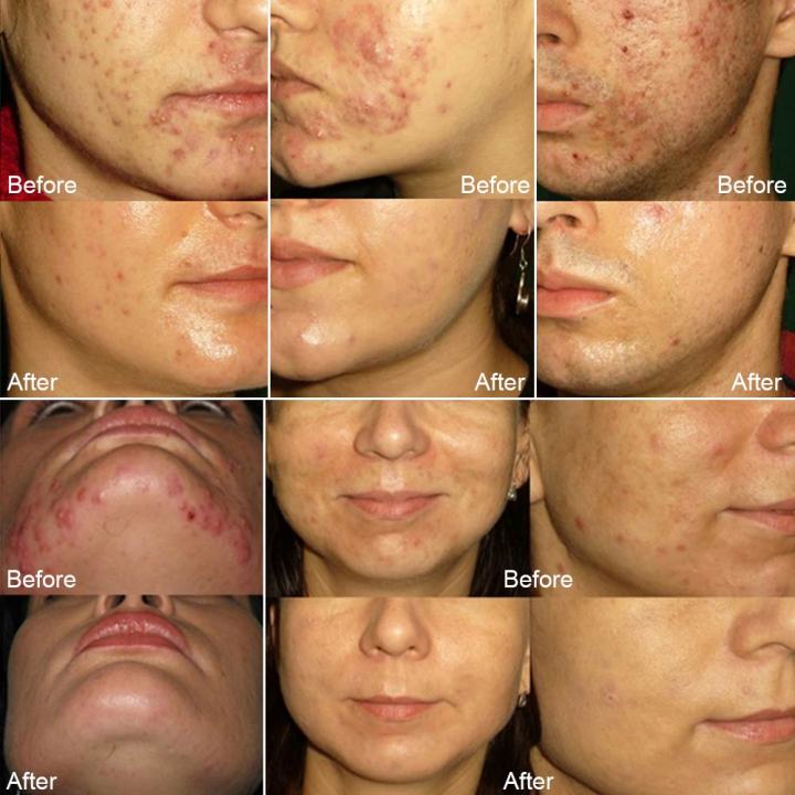 Soap%20Sea%20Salt%20Soap%20Goat%20Milk%20Cleaner%20Removal%20Pimple%20Pores%20Blackheads%20Acne%20Moisturizing%20Face%20Wash%20Handmade%20Soap%20Base%20Makeup%20Tool%20-%20Image%204