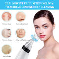Weja Black Heads Remover Vacuum Facial Pore Vacuum Cleaner Electric USB Rechargeable. 