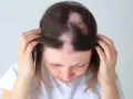 Ayurvedic Udugowwa Balm & Oil Pack – Effective Herbal Remedy for Hair Loss. 