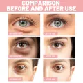 1-30 Pairs Rose Essence Eye Patches Anti-aging Hydrating Effective Remove Dark Circles Wrinkle Eyes Masks Eye Skin Care Products. 