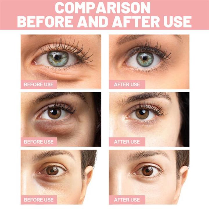 1-30%20Pairs%20Rose%20Essence%20Eye%20Patches%20Anti-aging%20Hydrating%20Effective%20Remove%20Dark%20Circles%20Wrinkle%20Eyes%20Masks%20Eye%20Skin%20Care%20Products%20-%20Image%202