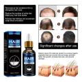 7-day Rapid Hair Growth Essential Oil Hair Regeneration Oil Anti-hair Loss Mild Repairs Hereditary Hair Essential Oil New. 