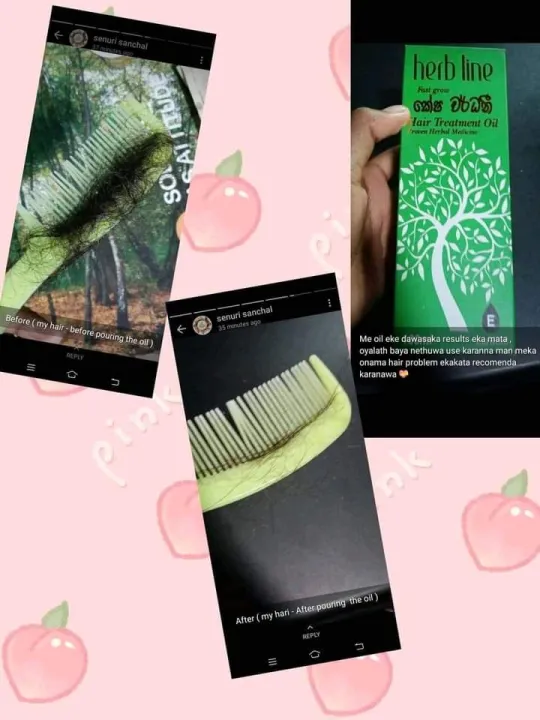 Herb%20Line%20Keshawardhani%20Hair%20Treatments%20Pack%20Oil%20100Ml%20,%20Shampoo%20200Ml%20&%20Conditioner%20200Ml%20(%20Herbline%20)%20-%20Image%207