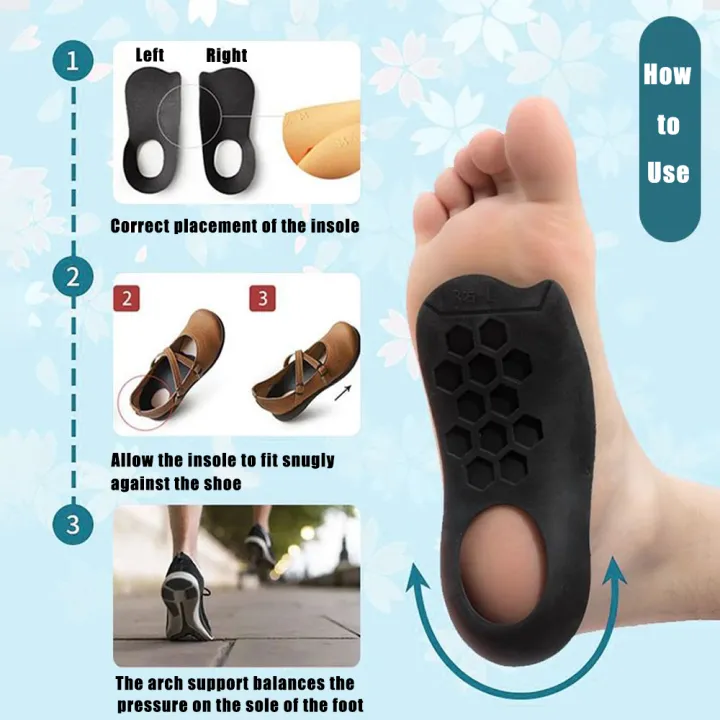 Orthotic%20Insoles%20for%20XO-Legs%20Correction%20Orthopedic%20Insoles%20Flat%20Foot%20Arch%20Support%20Pad%20Plantar%20Fasciitis%20Pain%20Relief%20Shoe%20Inserts%20-%20Image%203