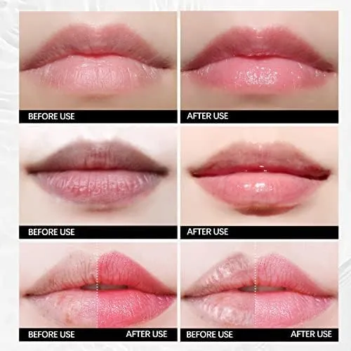 ALIVER%20Lip%20Mask%20Sheet%2010%20pcs,Collagen%20Lip%20Sleeping%20Masks%20for%20Dry%20and%20Dark%20Lips,%20ALIVER%20Original%20Skincare%20Nourishing%20Lip%20Balm%20for%20Women%20and%20Men%20%20FROM%20DUBAI(SAM)%20-%20Image%203