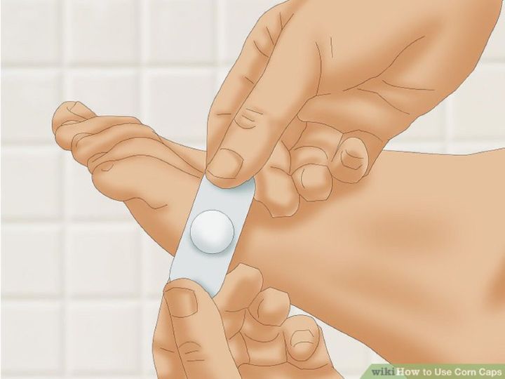 Medi%20Grip%20Corn%20Caps%20-%20CORN%20REMOVAL%20SELF%20ADHESIVE%20PLASTERS%20-%20Image%206