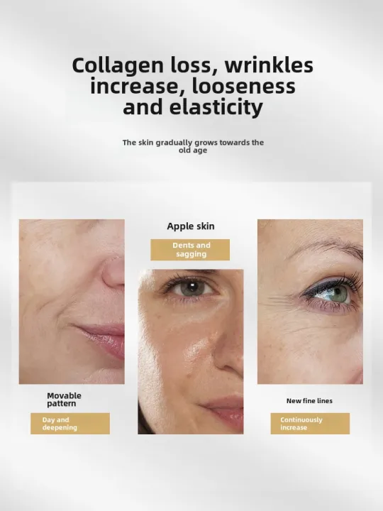 Happy%20day%20%E5%90%91%E7%BE%8E%E5%8D%9A%E5%A3%AB%20%E9%BB%84%E9%87%91%E8%83%B6%E5%8E%9F%E8%9B%8B%E7%99%BD%E6%8A%97%E7%9A%B1%E9%9C%9C%20Gold%20Collagen%20Wrinkle%20Lift%20Cream%20Firming%20Essence%20Cream%20Light%20Grain%20Small%20Molecule%20Pure%20Raw%20Material%20Skin%20Pulling%20Cream%20%E9%BB%84%E9%87%91%E8%83%B6%E5%8E%9F%E8%9B%8B%E7%99%BD%E6%8A%97%E7%9A%B1%E9%9C%9C%20-%20Image%204