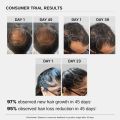 Bare Anatomy Advanced Hair Growth Serum| 3% Redensyl - 2x Better Results than Minoxidil | + 4% Anagain + 3% Baicapil | Rosemary, Biotin | Hair growth & Hair fall control serum for Women & Men | 30mL. 