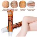 Sumifun  Varicose Veins Miracle  Ointment Relief Veins Pain Phlebitis Spider legs cream. 