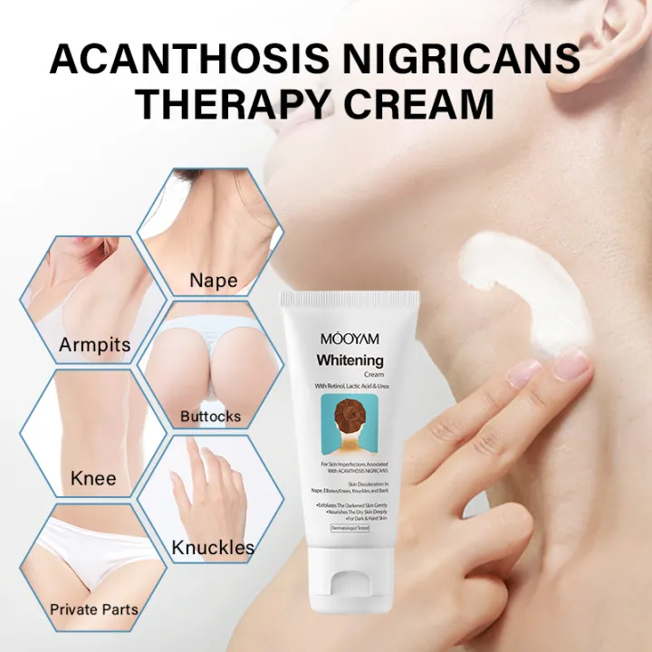 %E3%80%90In-demand%E3%80%91%20Acanthosis%20Nigricans%20Therapy%20Neck%20Cream%20Skin%20Tightening%20Underarm%20Elbows%20Armpit%20Cream%20Treatment%20Dark%20Spot%20Remover%20For%20Body%20-%20Image%207