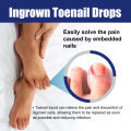 Ingrown Toenail Treatment Serum Paronychia Nail Softener Correction Relieve Pain Anti Fungal Inflammation Nail Repair Essence. 