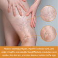 South Moon Vein Repair Cream Relieves Swollen and Sore Legs Repairs Earthworm Legs Vein Massage Treatment. 