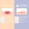 FOCALLURE 2pcs Acne Patch Transparent Invisible Pimple Remover Tool Day And Night 2 Sizes Acne Sticker Face Skin Care Product. 