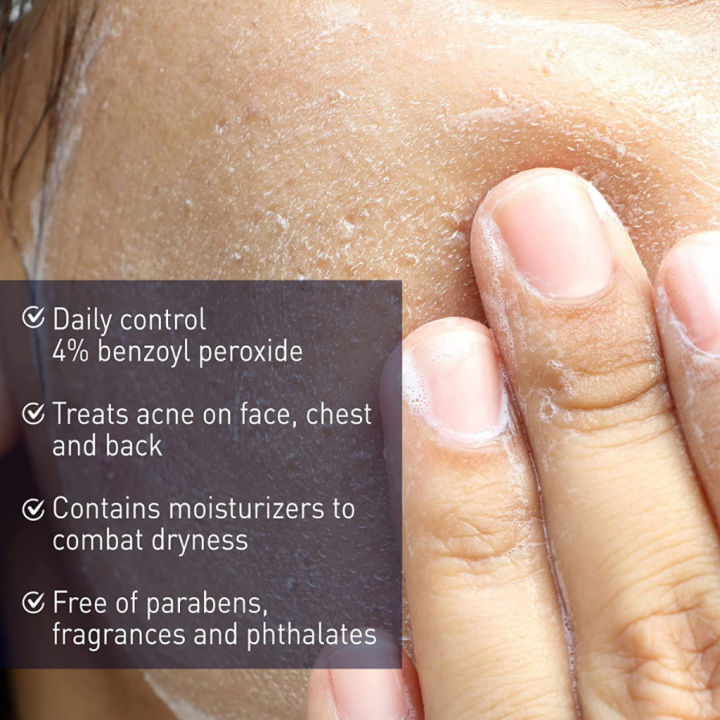 %5BSG%5D%20PanOxyl%20Acne%20Creamy%20Wash%204%25%20Benzoyl%20Peroxide%20Daily%20Control%20Facial%20Cleanser%20Skin%20Care,%20170g%20-%20Image%203
