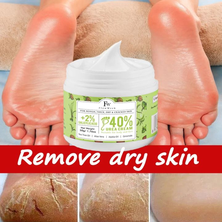 FlowWeek Foot Fungus Removal Cream Relieve Foot Itching