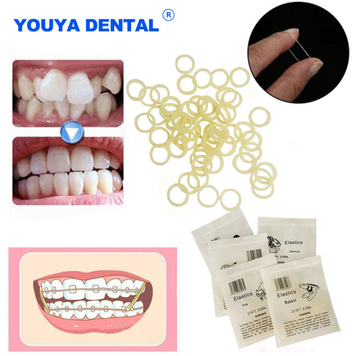 100pc/bag Dental Elastics Latex Rings Braces Dental Rubber Band Non-toxic Materials 3.5OZ Dentist Rubber Bands