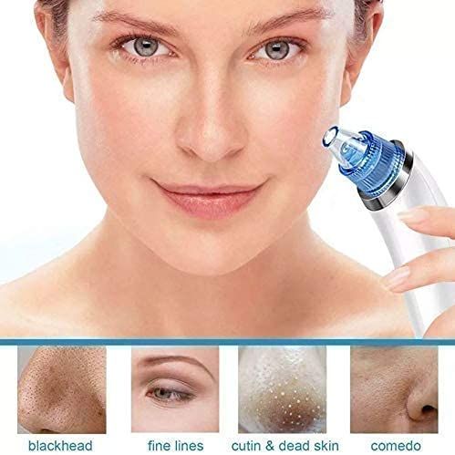 4%20in%201%20Multi-function%20Blackhead%20Remover%20Vacuum%20Pimple%20Tool%20For%20Men%20And%20Women%20Blackheads%20Remover%20Tool%20Kit,%20Acne%20Remover,%20Pore%20Cleaner,%20Facial%20Beauty%20Care%20-%20Image%203