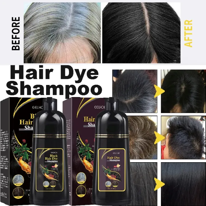 Black%20Hair%20Dye%20Shampoo%20White%20Hair%20Dye%20To%20Black%20Shampoo%20Activate%20Hair%20Follicle%20Melanin%20White%20Treatment%203%20In%201%20For%20Men%20Women%20-%20Image%202