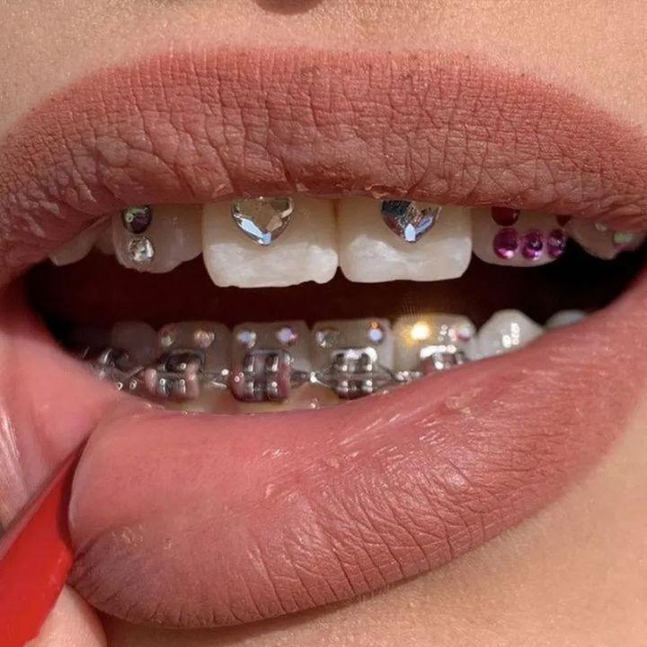 Tooth%20Gem%20Set%20Glue%20Kit%20with%20UV%20Curing%20Light%20Dental%20Orthodontic%20Adhesive%20Jewelry%20Diamond%20Crystals%20Ornament%20Direct%20Bonding%20System%20-%20Image%205
