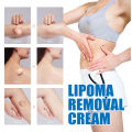 Lipoma Removal Cream Relief Pain Treat Skin Swelling Lipolysis Cellulite Fat Lump Nodule Removal Ointment Anti-tumor Plaster. 