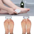Vastate Personal Care Oval Shape Pumice Stone Scrubber for Body and Foot White. 
