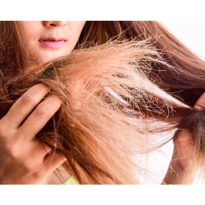 L'OREAL%20paris%20elvive%20total%20repair%205%20repairing%20shampoo%20400ml%20(%20DAMAGED%20HAIR%20)%20-%20Image%205