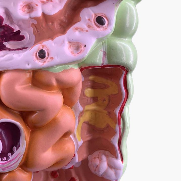 Sojhoop Human Digestive System Model Stomach Anatomy Large Intestine ...