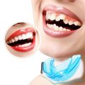 Soft Orthodontic Brace Buck Teeth Retainers Orthodontic Appliance Trainer blue. 