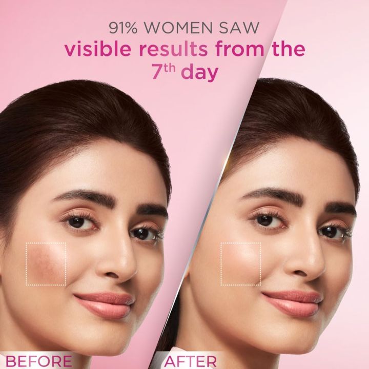 Pond's%20Bright%20Beauty%20Anti-Pigmentation%20Serum%2014ml%20FROM%20INDIA%20(SAM)%20-%20Image%204